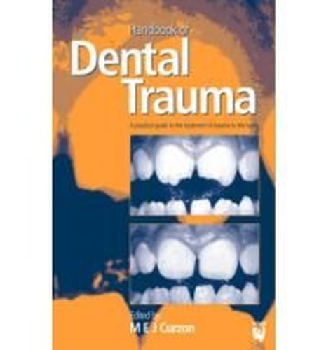 Handbook of Dental Trauma