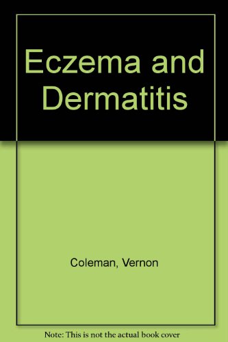 Eczema and Dermatitis