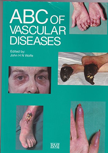 ABC of Vascular Diseases