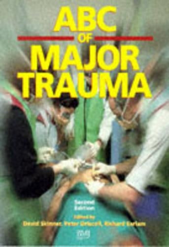 ABC of Major Trauma