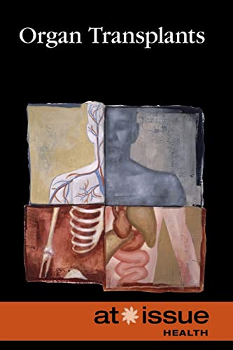 Organ Transplants