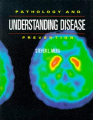 Understanding Disease