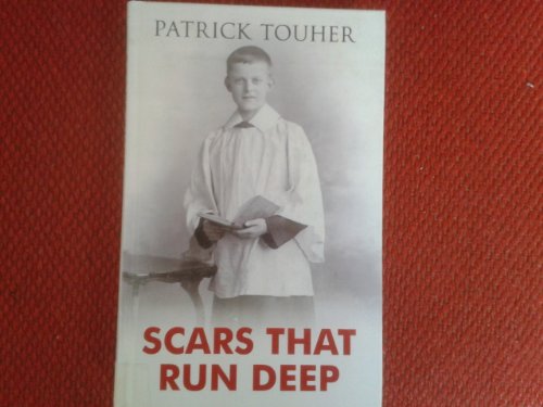 Scars That Run Deep