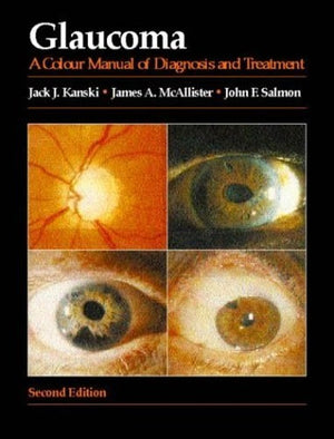 Glaucoma