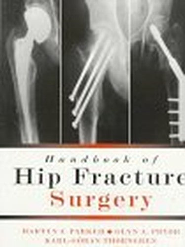 Handbook of Hip Fracture Surgery
