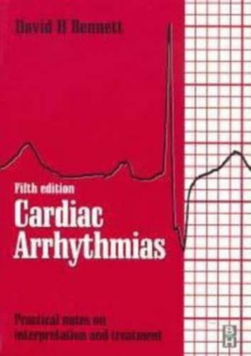 Cardiac Arrhythmias