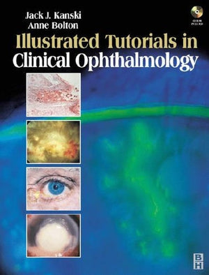 Illustrated Tutorials in Clinical Ophthalmology with CD-ROM