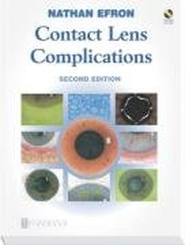 Contact Lens Complications