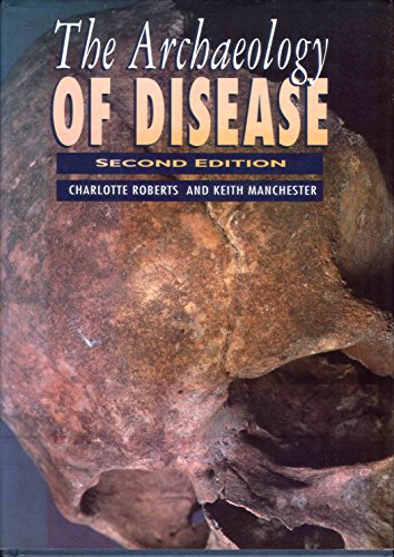 The Archaeology of Disease