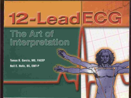 12-lead ECG