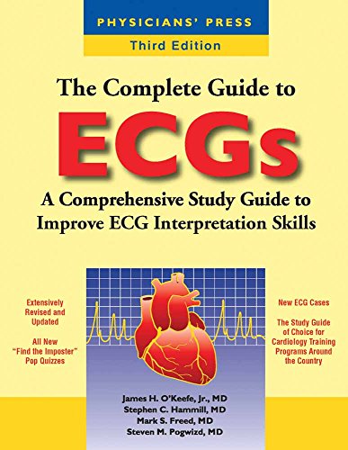 The Complete Guide to ECGs