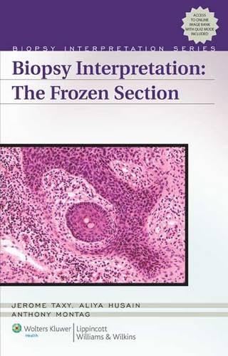 Biopsy Interpretation: The Frozen Section