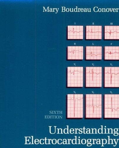 Understanding Electrocardiography