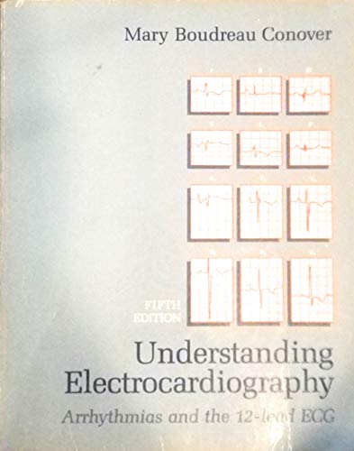 Understanding Electrocardiography