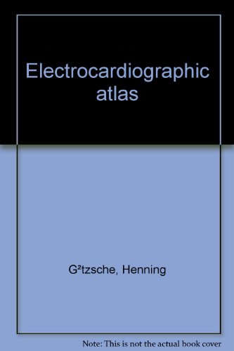 Electrocardiographic Atlas