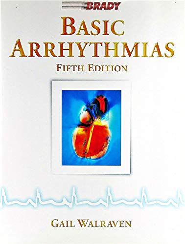 Basic Arrhythmias