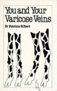 You and Your Varicose Veins 