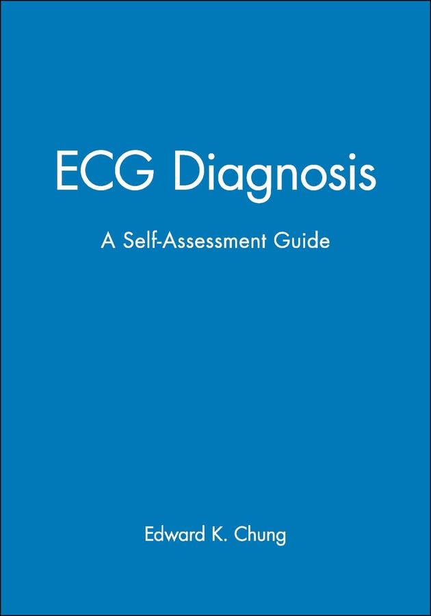 ECG Diagnosis