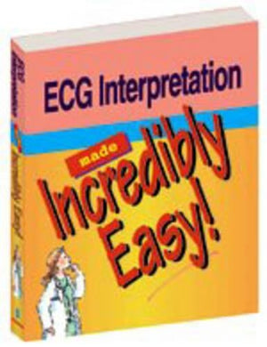 Electrocardiogram Interpretation Made Incredibility Easy