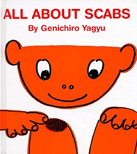 All about Scabs
