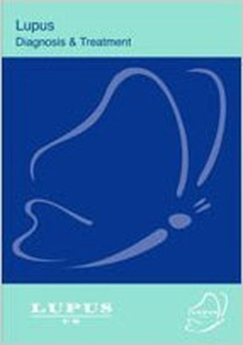 Lupus Diagnosis and Treatment