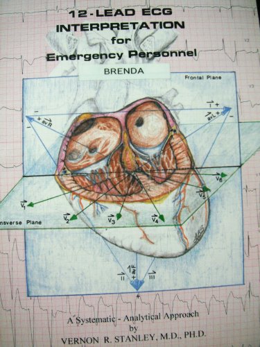 12-Lead ECG Interpretation for Emergency Personnel