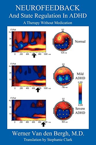 Neurofeedback and State Regulation in ADHD