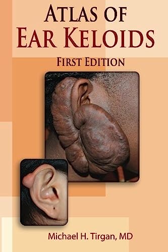 Atlas of Ear Keloids