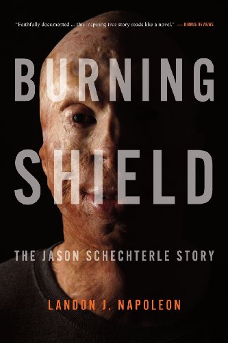 Burning Shield