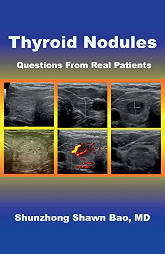 Thyroid Nodules