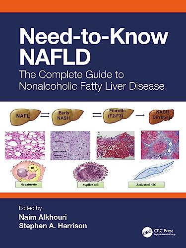 Need-to-Know NAFLD