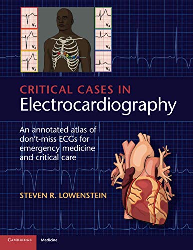 Critical Cases in Electrocardiography