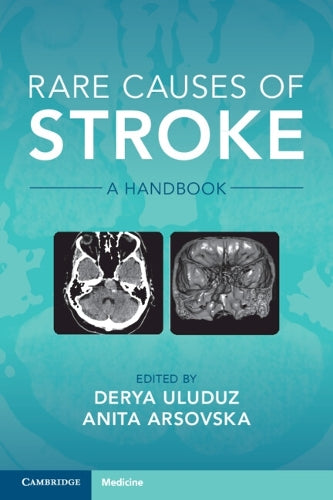 Rare Causes of Stroke