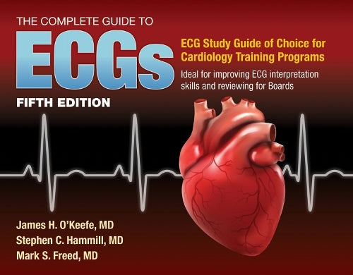 The Complete Guide to ECGs: a Comprehensive Study Guide to Improve ECG Interpretation Skills