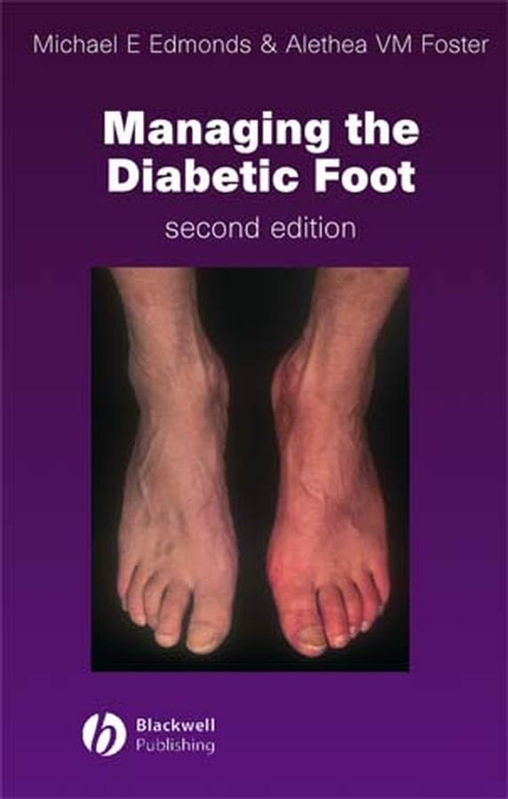 Managing the Diabetic Foot
