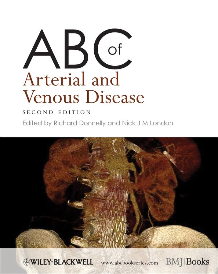 ABC of Arterial and Venous Disease