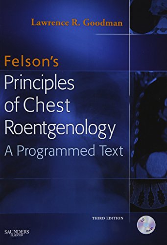Felson's Principles of Chest Roentgenology
