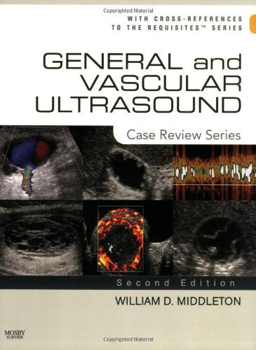 General and Vascular Ultrasound