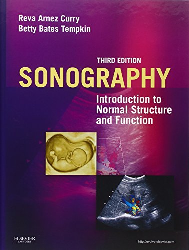 Sonography