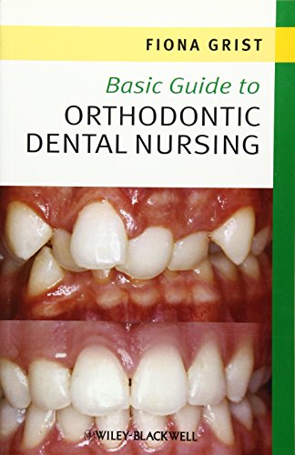 Basic Guide to Orthodontic Dental Nursing