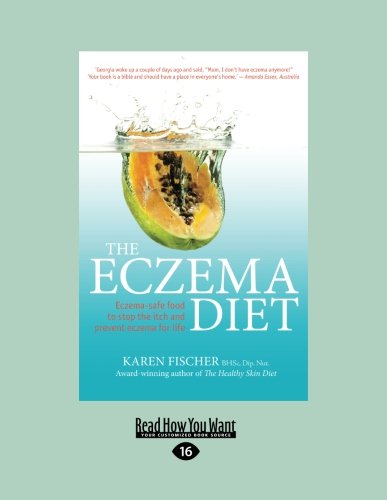 The Eczema Diet