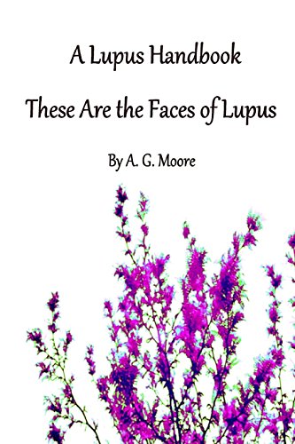 A Lupus Handbook