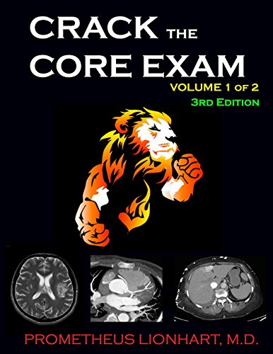 Crack the Core Exam - Volume 1