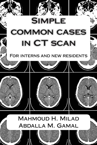 Simple common cases in CT scan