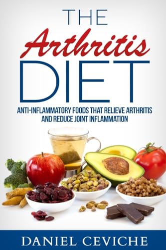 Arthritis Diet