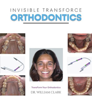 Invisible TransForce Orthodontics