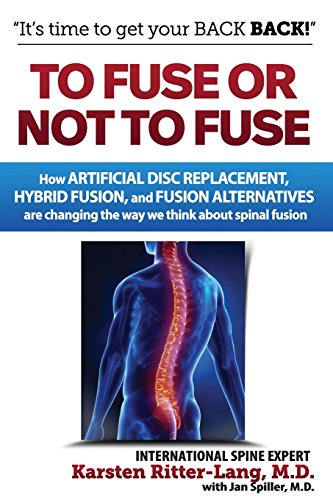 To Fuse or Not to Fuse