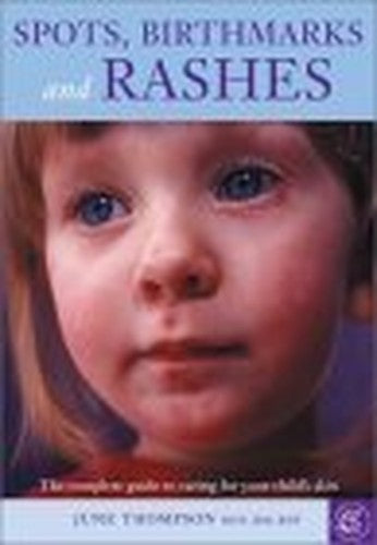 Spots, Birthmarks and Rashes