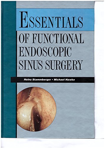 Essentials of Functional Endoscopic Sinus Surgery
