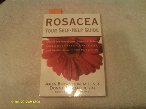 Rosacea